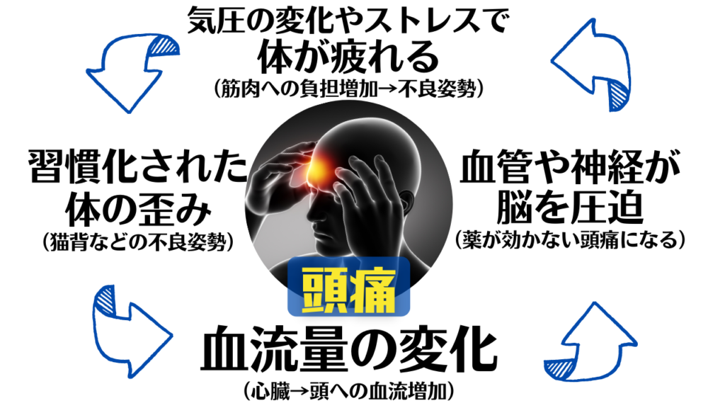 頭部への血流量の増加や脳の神経圧迫を引き起こす原因は身体の歪み