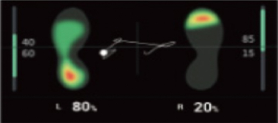 体の歪みの施術