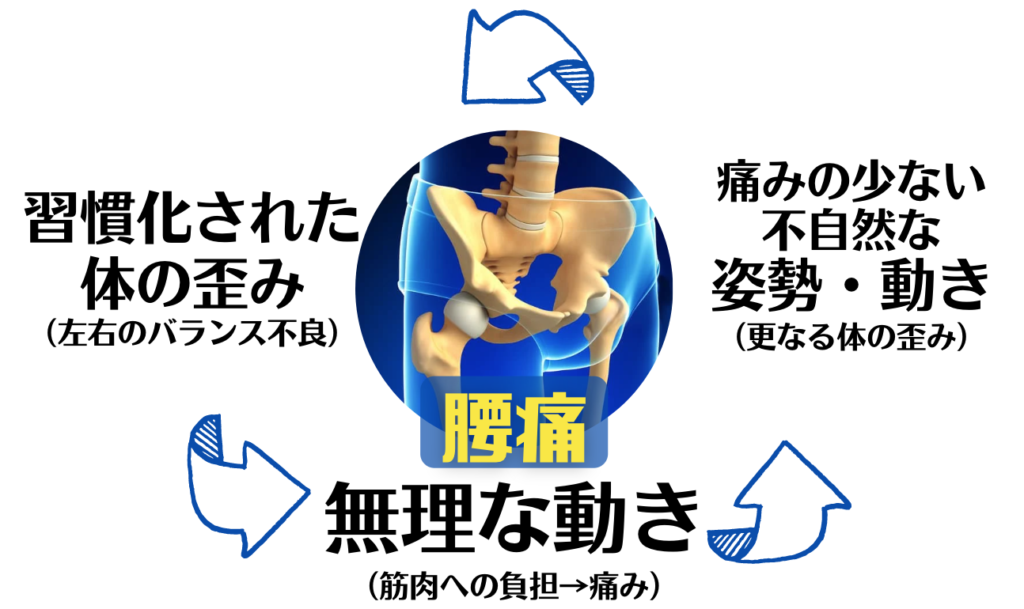 原因不明の腰痛のほとんどは骨盤や骨格の歪みが原因